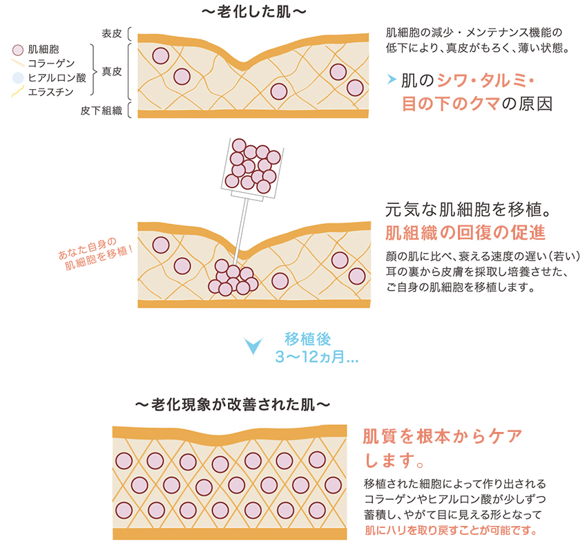 老化した肌を改善するプロセス